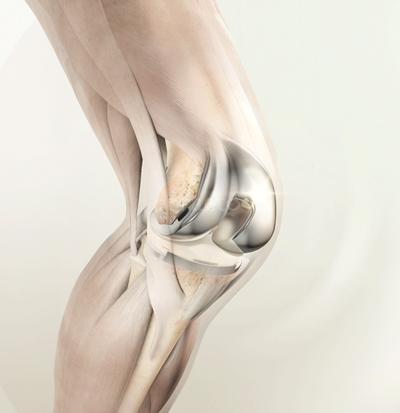 Bone and Joint Clinic